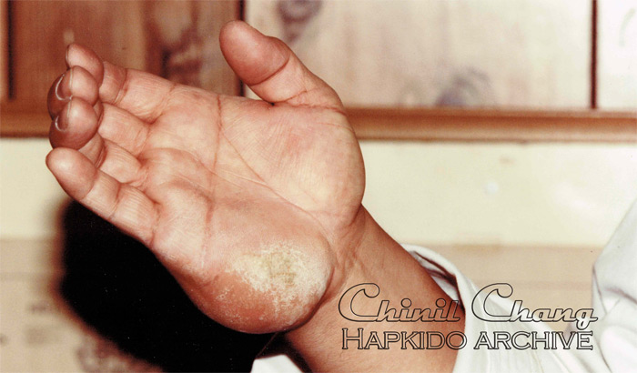 Extreme Hand Conditioning